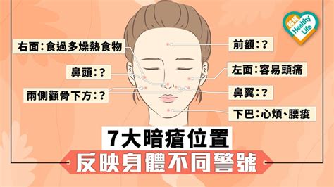 暗瘡位置|暗瘡位置反映身體問題｜中醫拆解13個部位：下巴、眉 